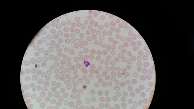 Blood Slides - Blood 002 400X